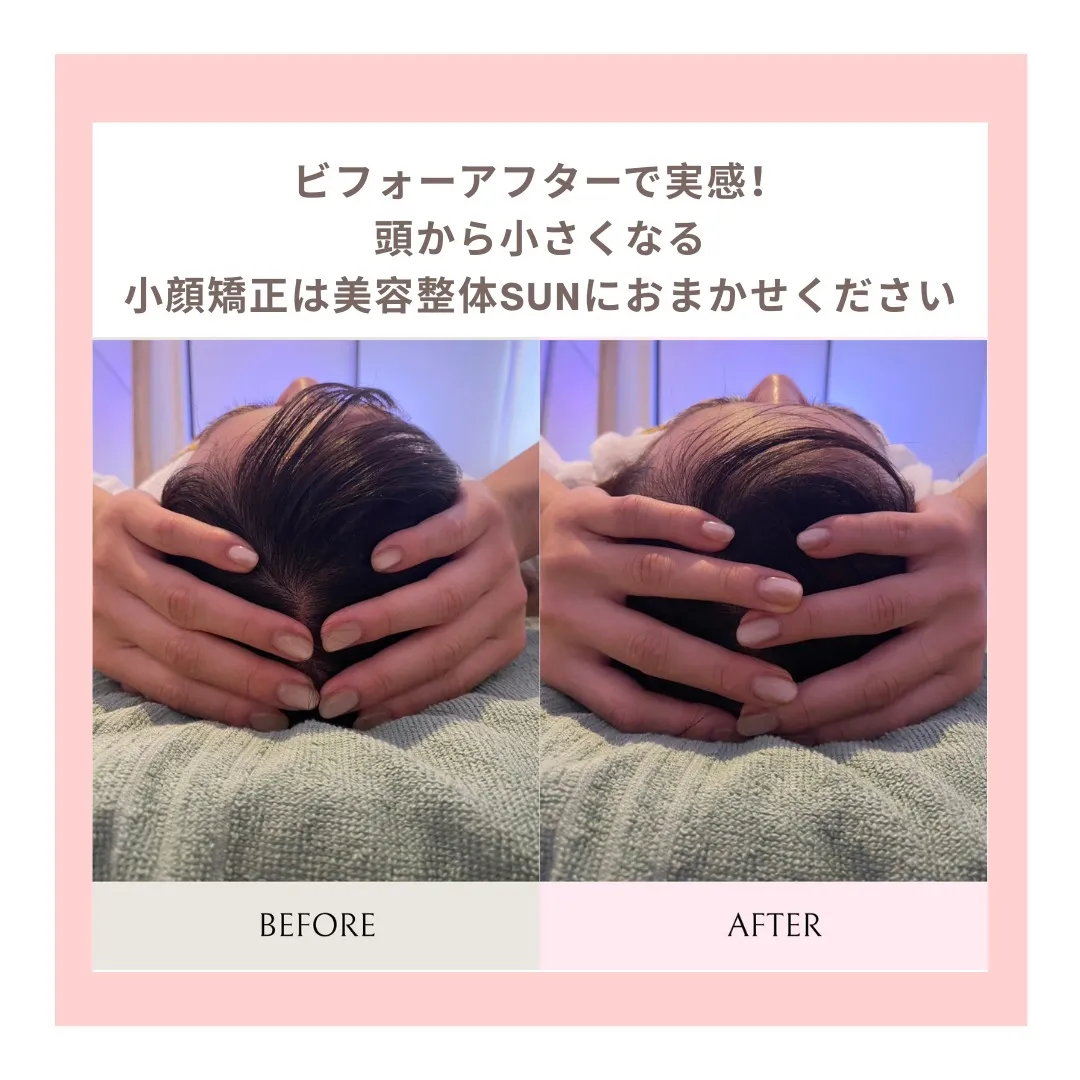 ✨美容整体SUNの小顔矯正✨